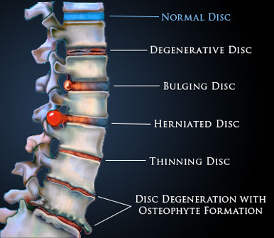 BACK PAIN TREATMENT IN BILOXI