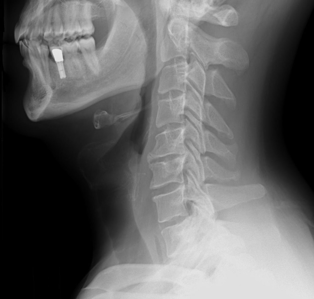 What Can I Do for My Neck Curve?