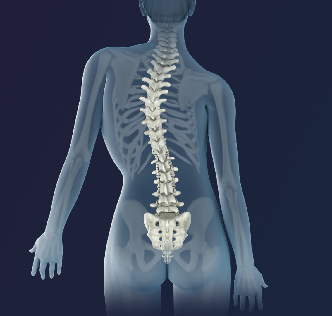 How do I Correct My Scoliosis?