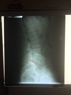 Radiographic Evaluation: X-Rays are taken on site as needed