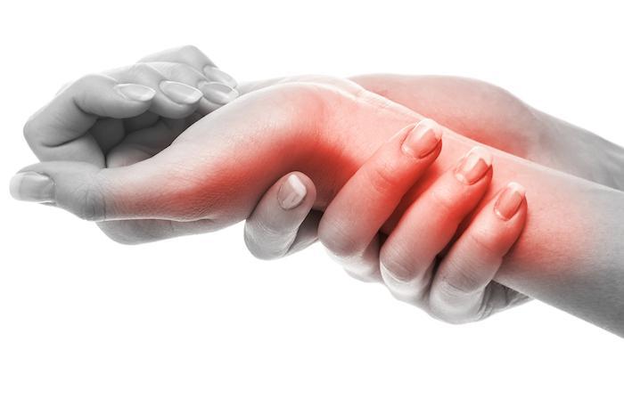 Carpal Tunnel Q&A