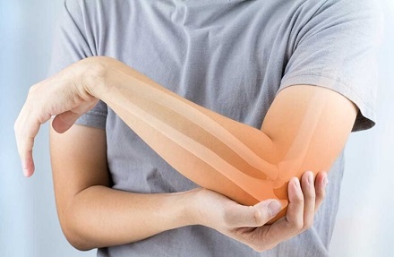Tendonitis