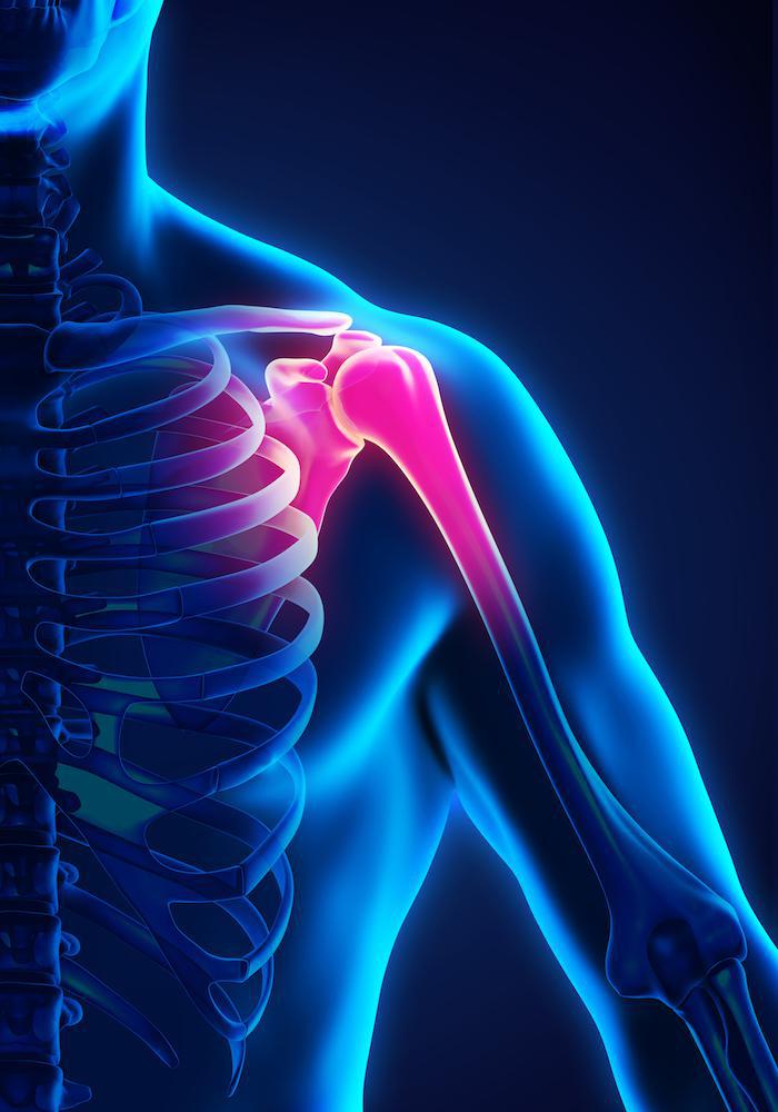 Shoulder Pain Q&A