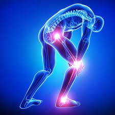 Sciatica Q&A