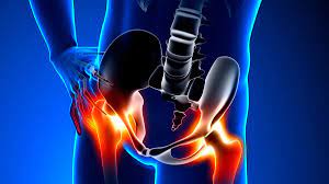 Hip Pain