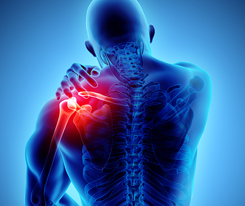Shoulder Pain