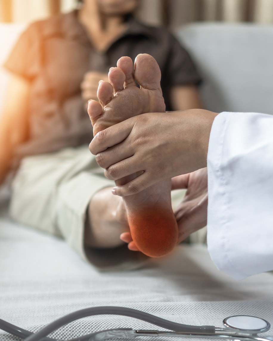 Plantar Fasciitis Q&A
