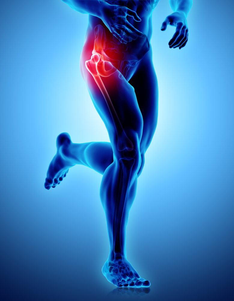 Hip Pain Q&A
