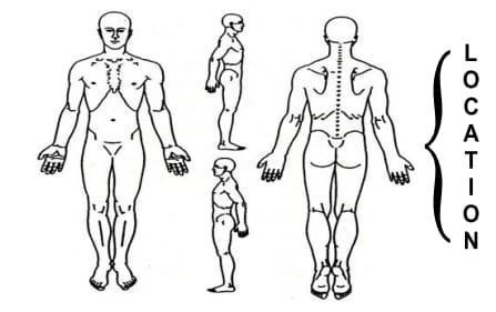 Mark Your Pain Point