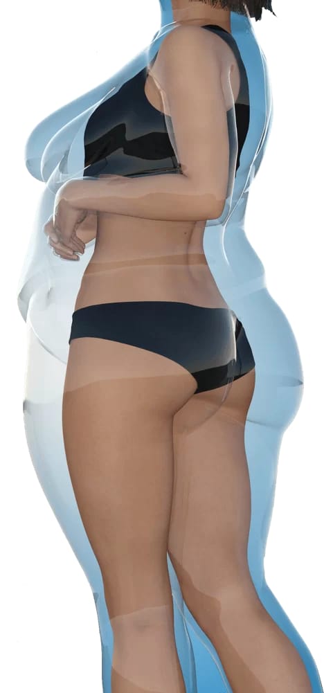 Weight Loss
