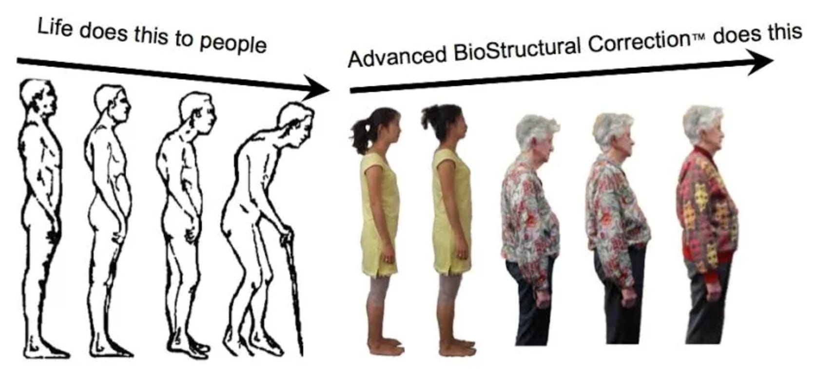 More About Advanced BioStructural Correction