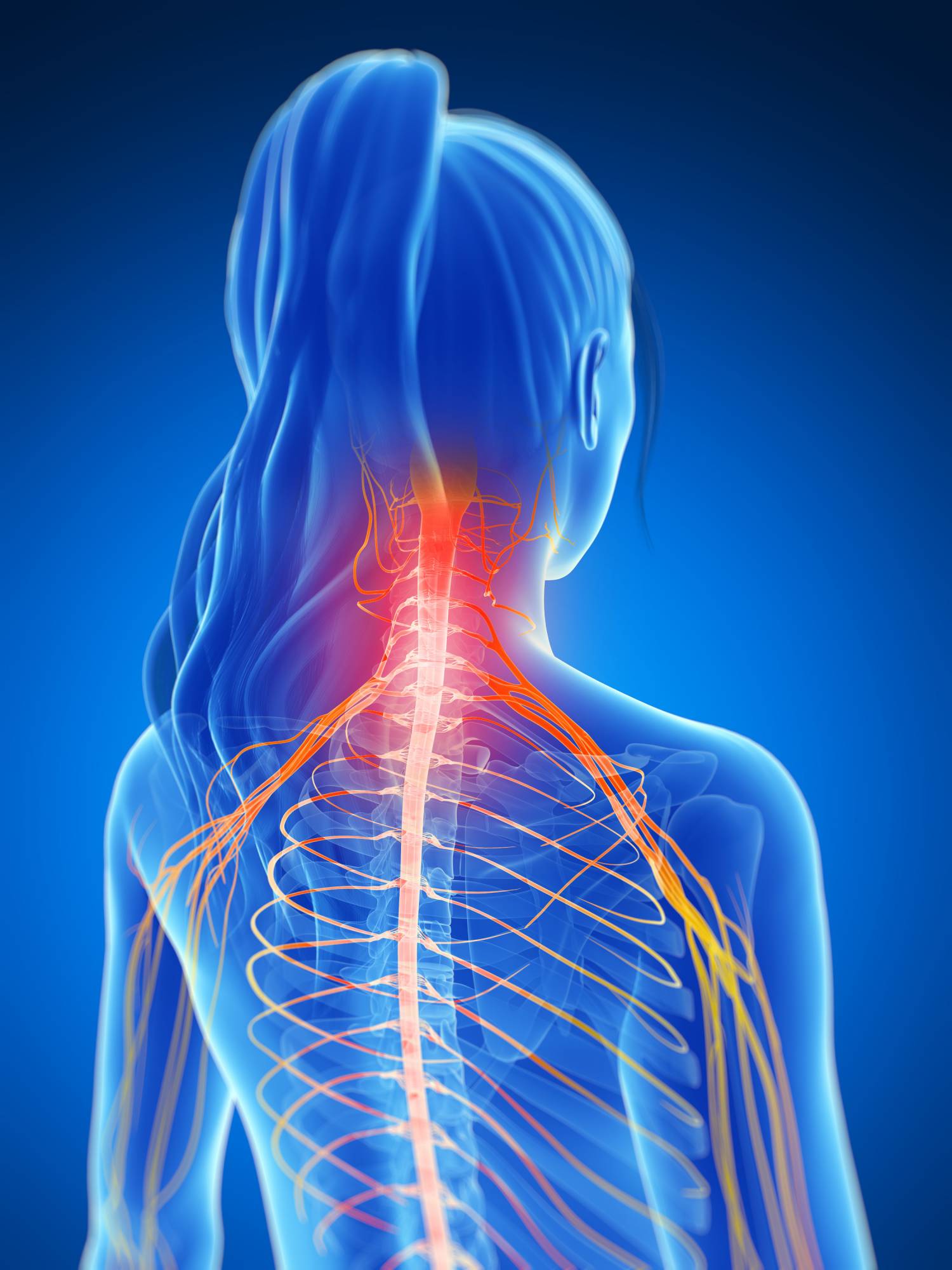 Neck Pain