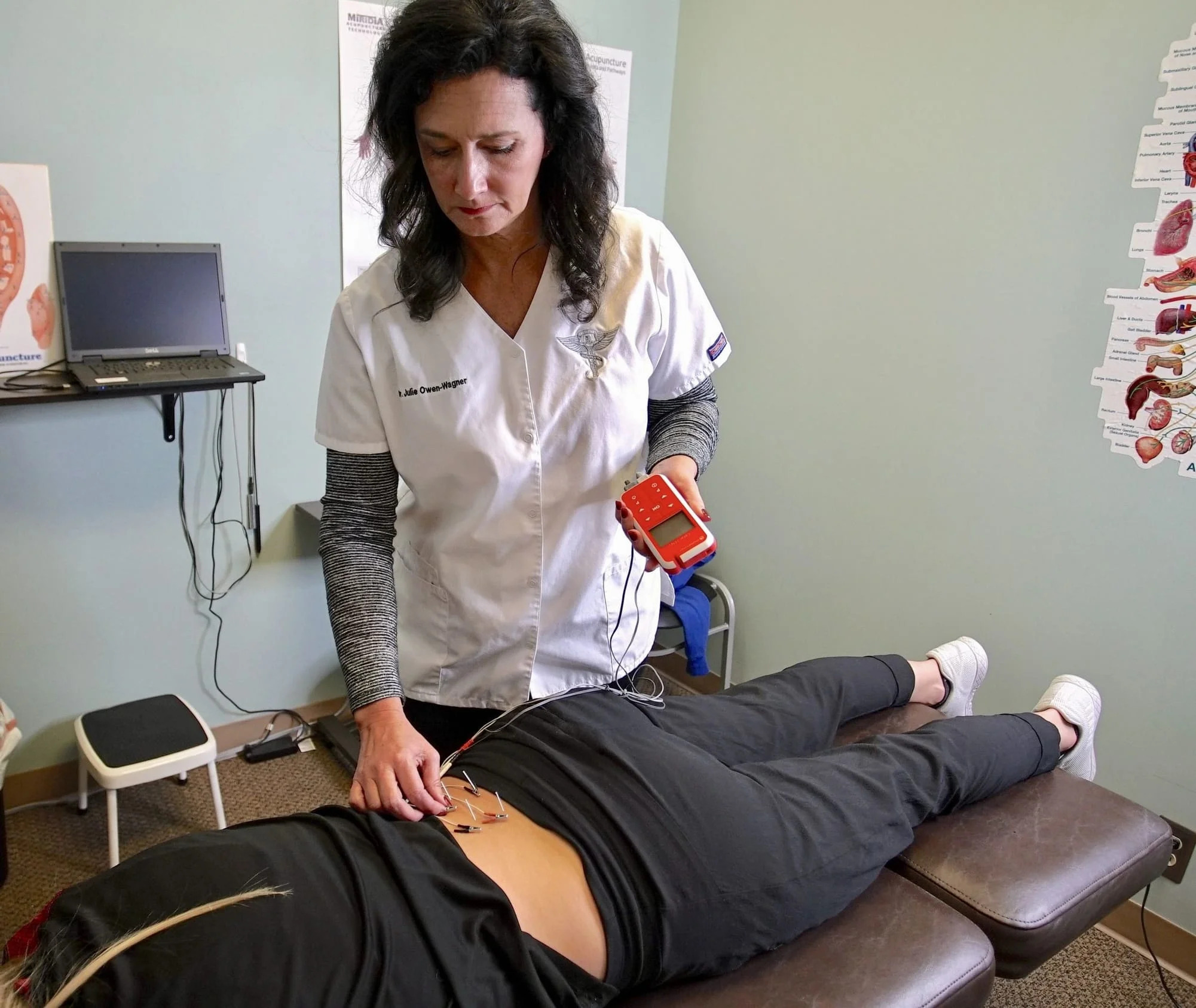 Acupuncture