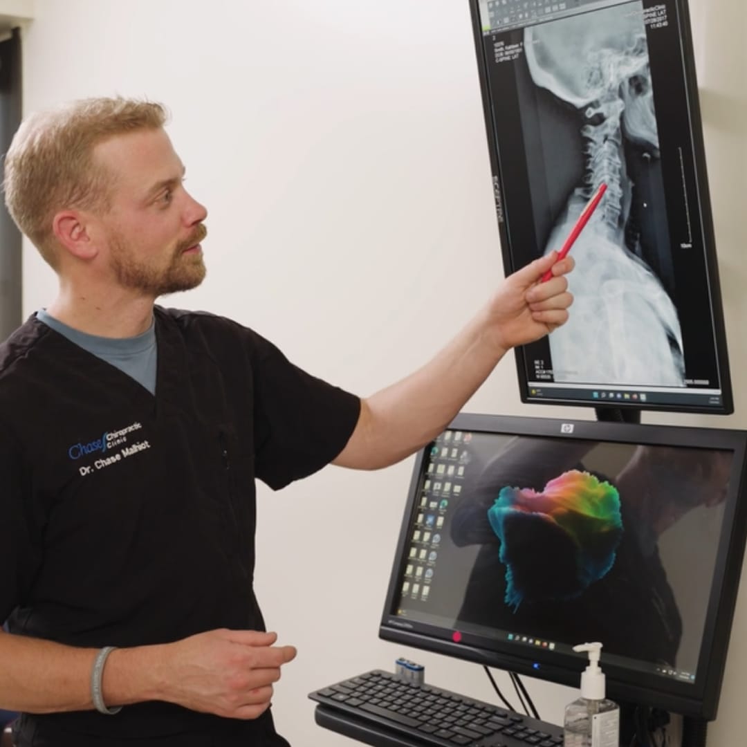 X-Rays