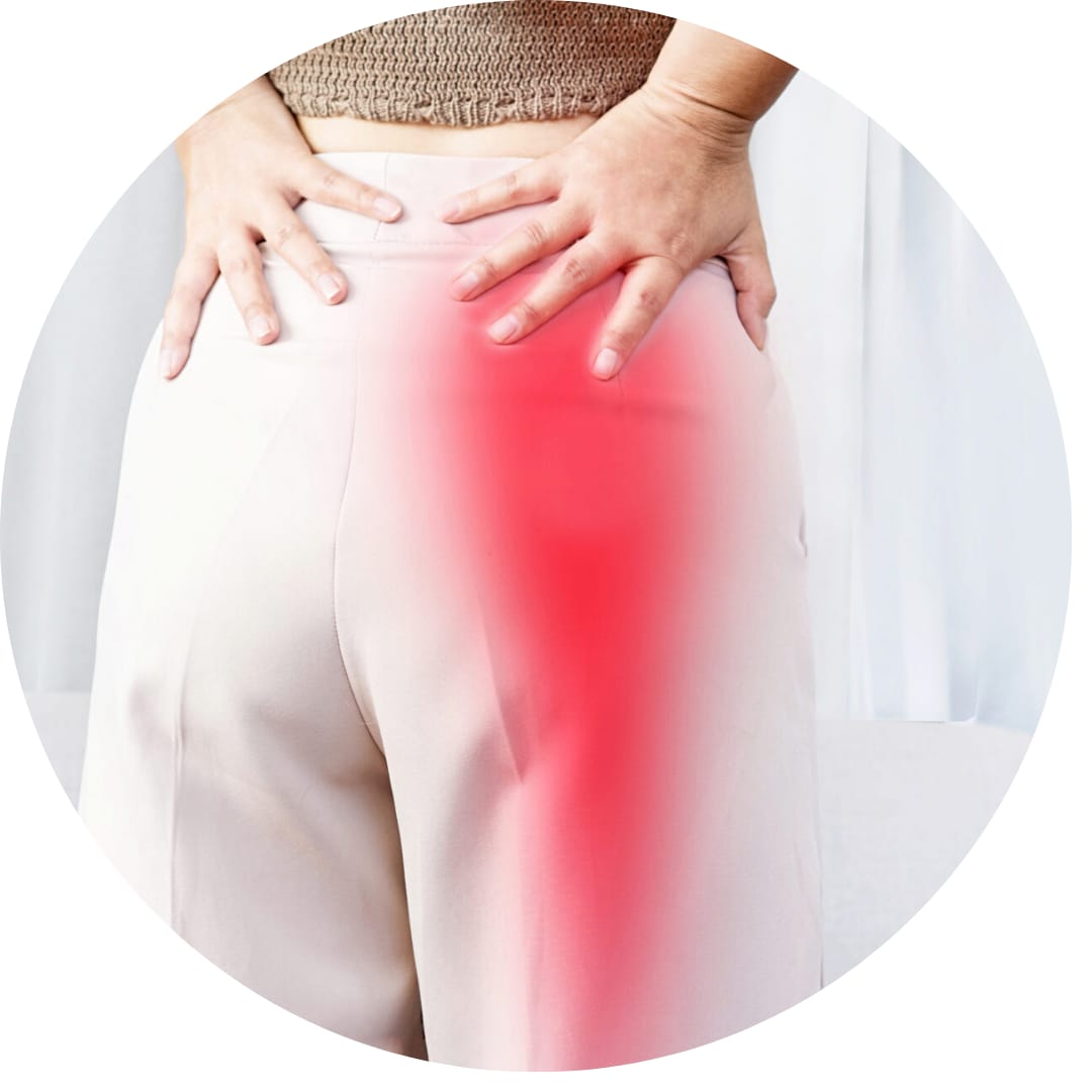 Sciatica