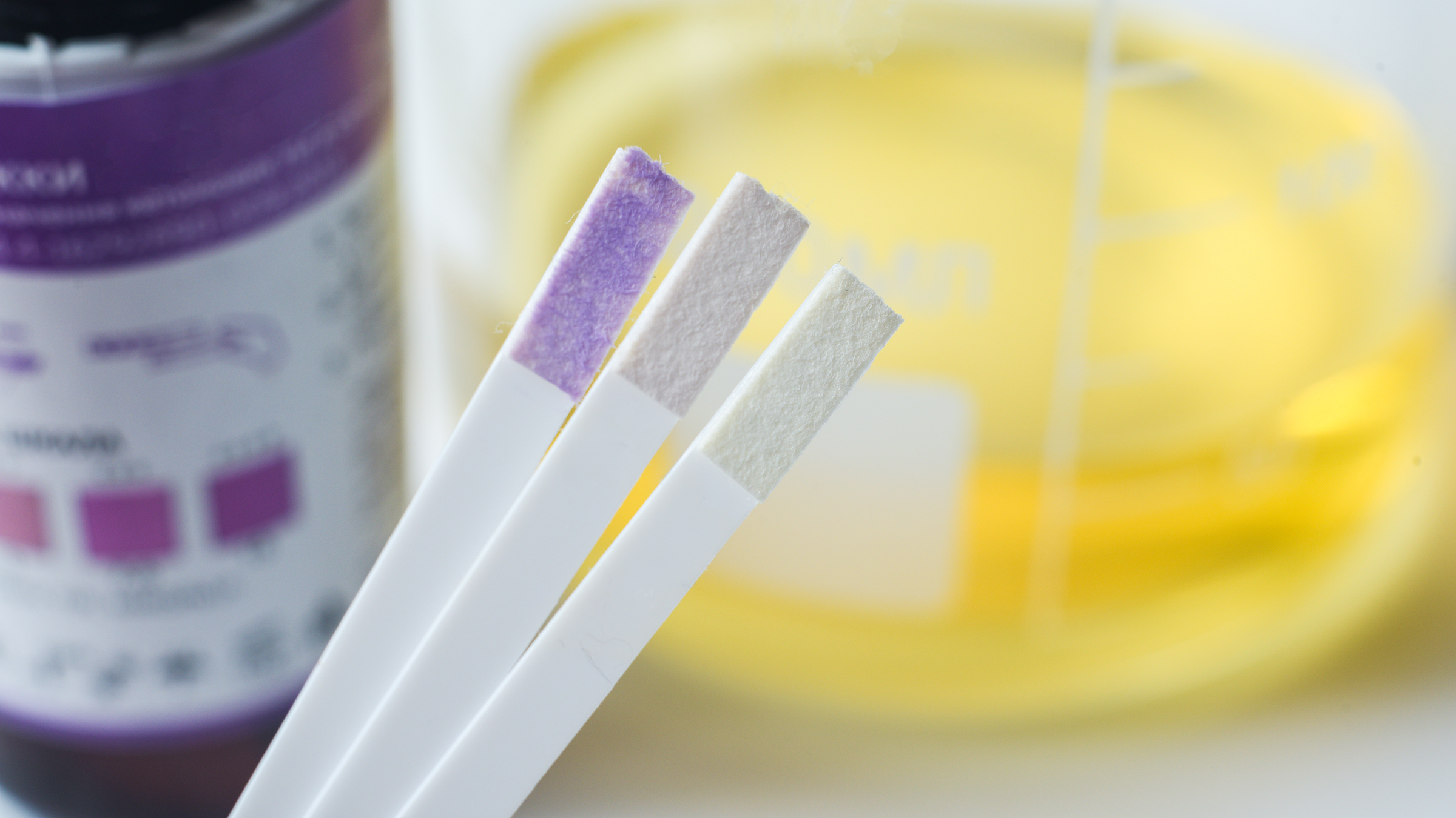 Drug Testing