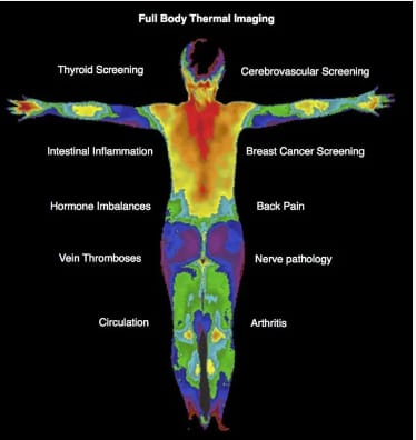Thermography at Zimmerman Chiropractic