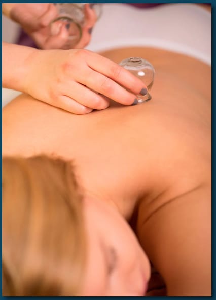 Cupping and Gua Sha