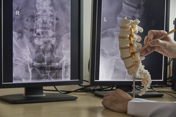 Digital X-Rays