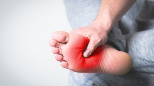 PRICE is the new RICE: How to Treat a Sprained Ankle At Home