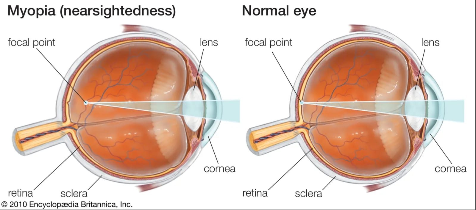 Myopic Management
