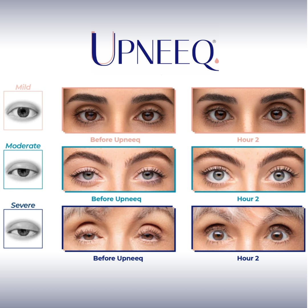 Droopy Eyelid