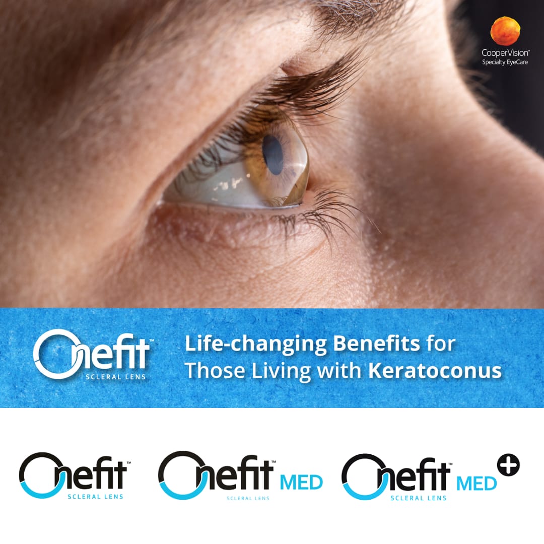 Keratoconus