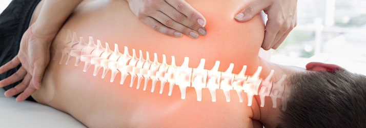 Scoliosis