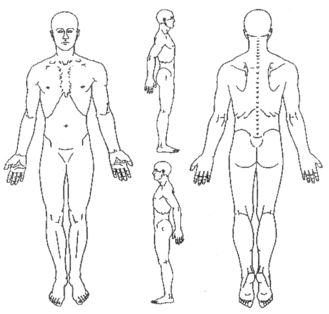 Please mark your areas of pain on the diagram below